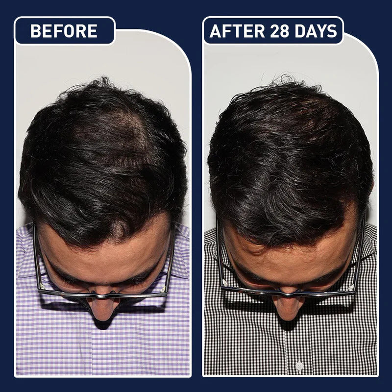 FEG PLUS HAIR SERUM - Made In USA