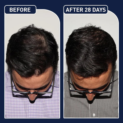FEG PLUS HAIR SERUM - Made In USA
